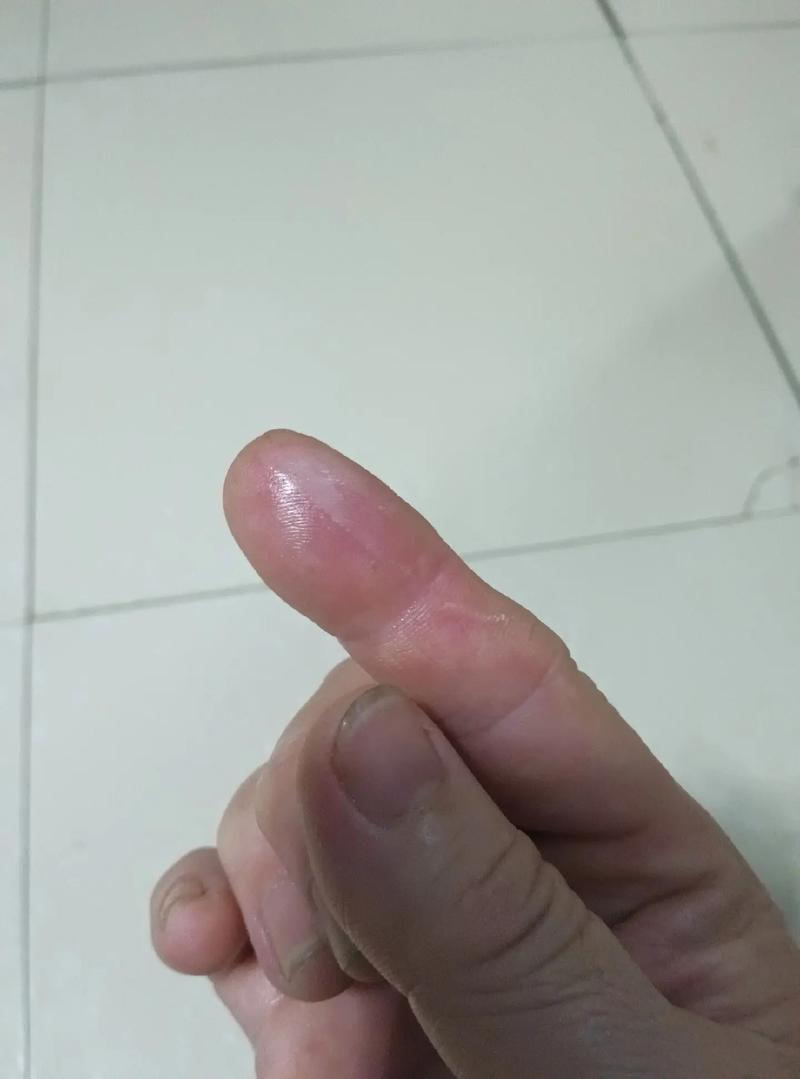 左眼皮跳跳，这些症状要警惕！