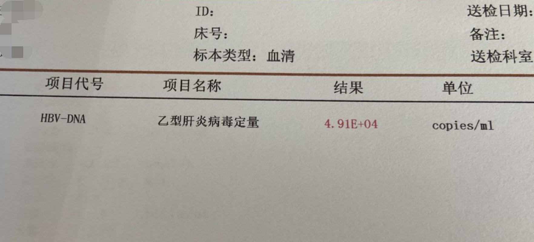 乙肝病毒DNA1.20e+2，是轻微复制吗？