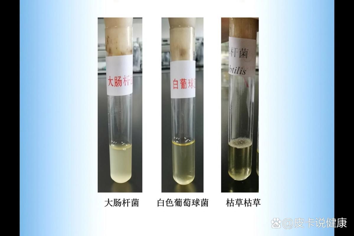 cfu/ml代表什么？培养细菌数量的单位解读！