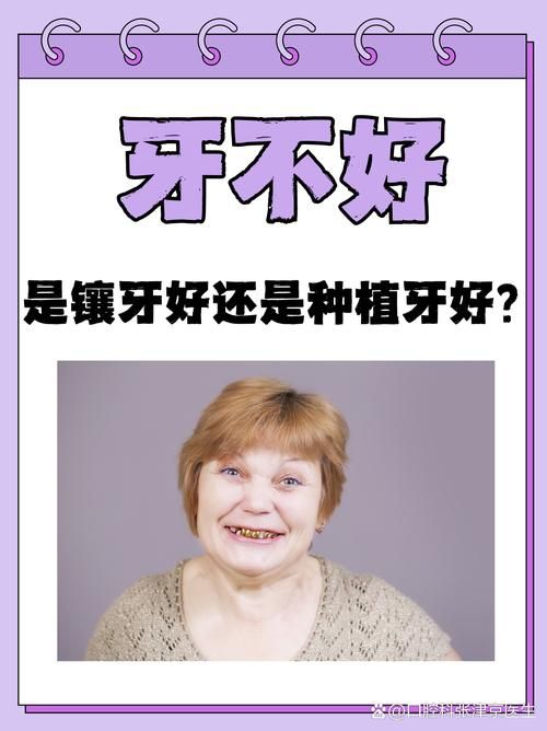 fcm是什么意思？这篇文章解答你所有的疑问！