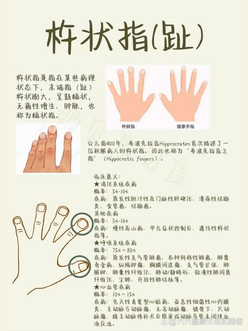 三指是什么意思？看完这篇你就懂了（内含详细解释）！