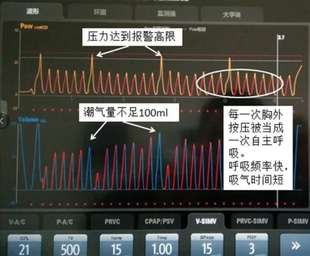 世界自定义模式是什么？看完这篇你就懂了！