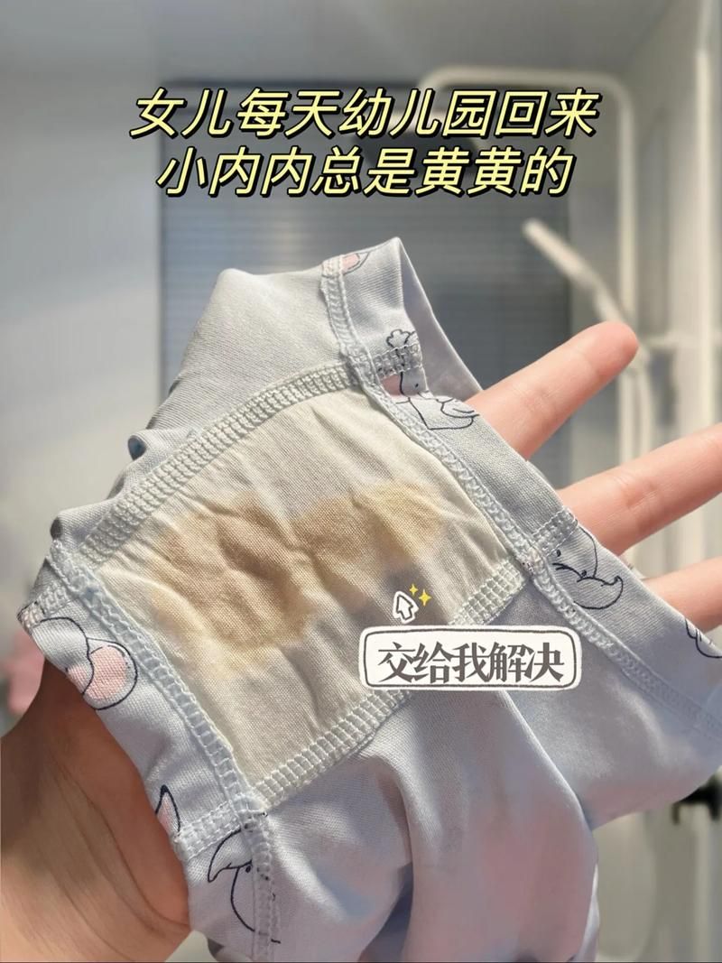内裤上有少量粪便正常吗？看完你就知道了！