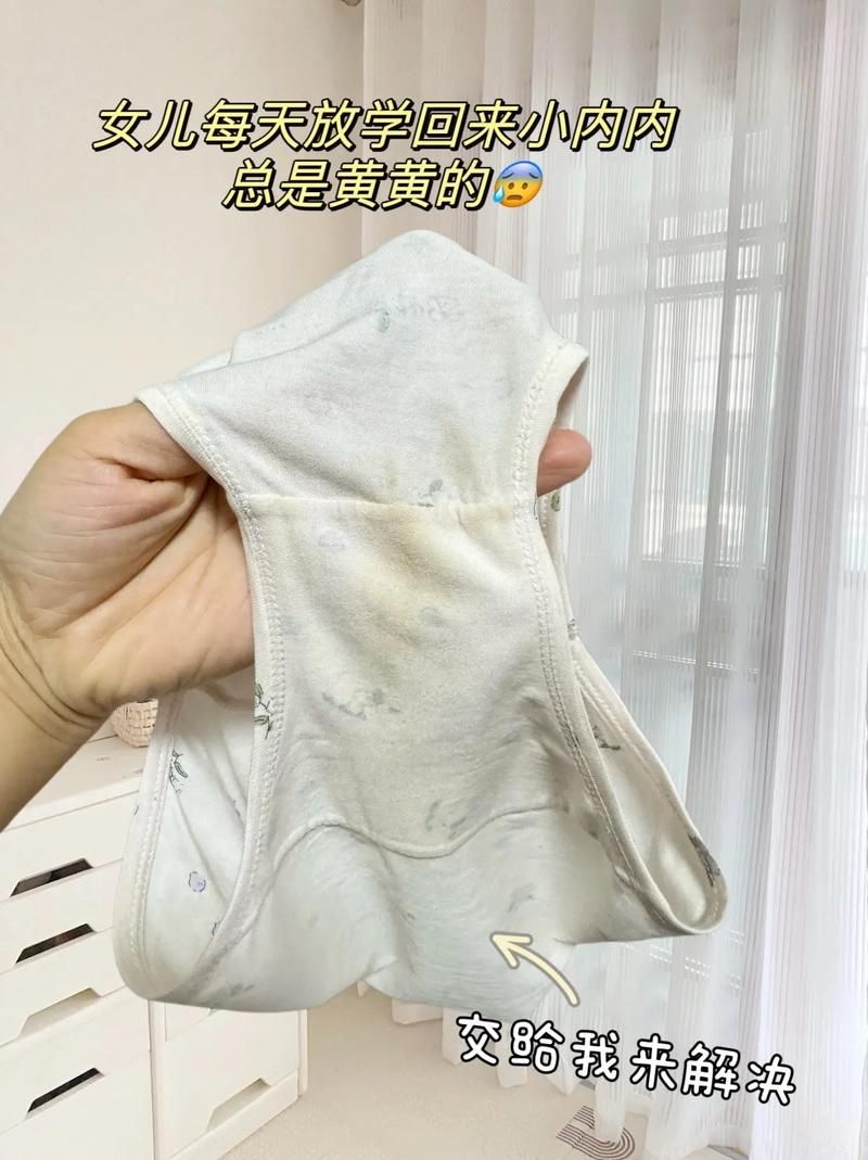 内裤上有少量粪便正常吗？看完你就知道了！