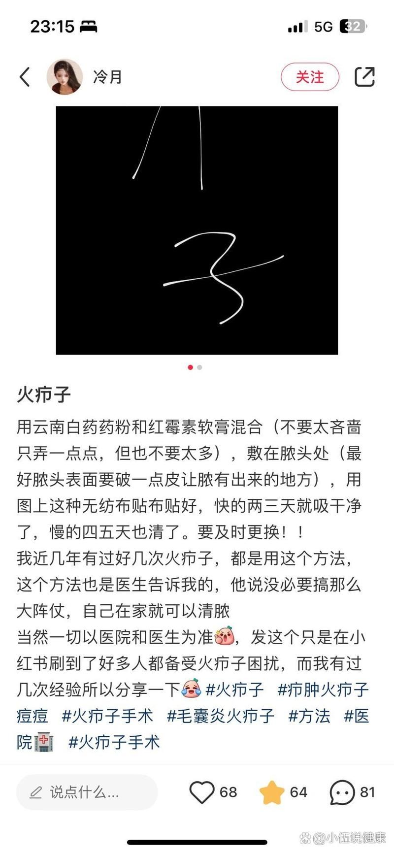 大比兜子是什么意思？这个词是怎么火起来的？