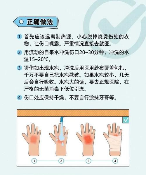 热油烫伤急救处理方法是什么？应该涂抹什么药膏？