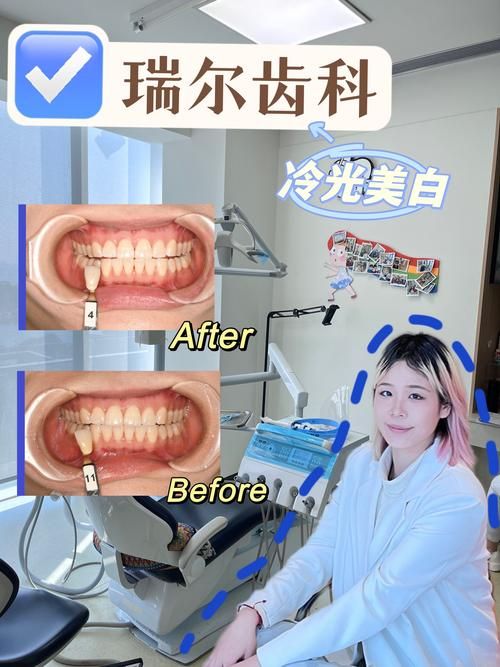 牙齿上出现小白点，需要看牙医吗？