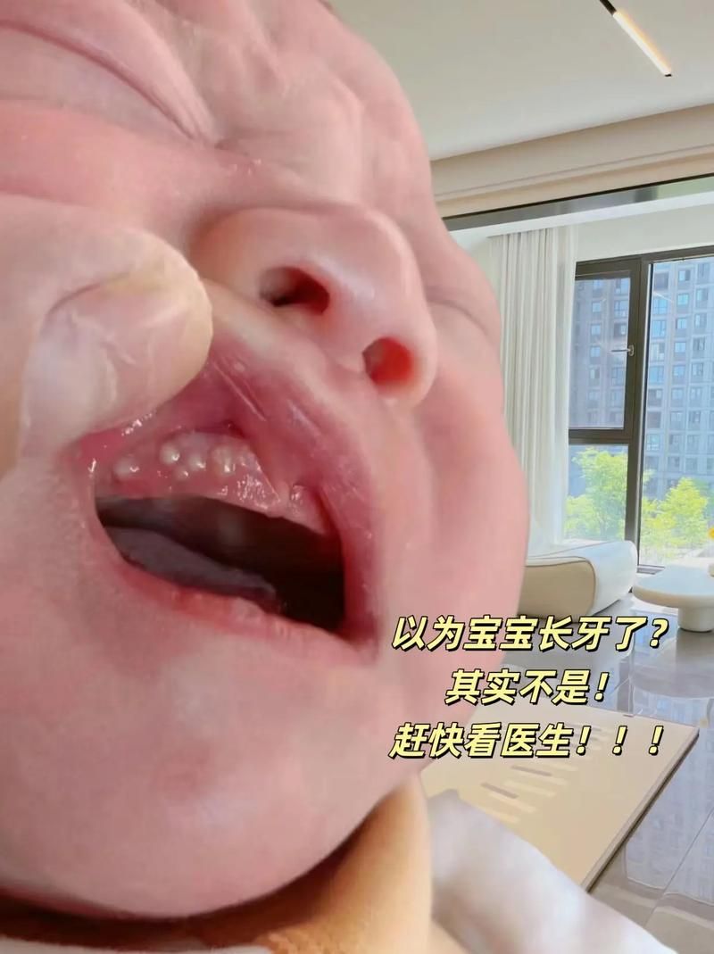 牙齿上出现小白点，需要看牙医吗？