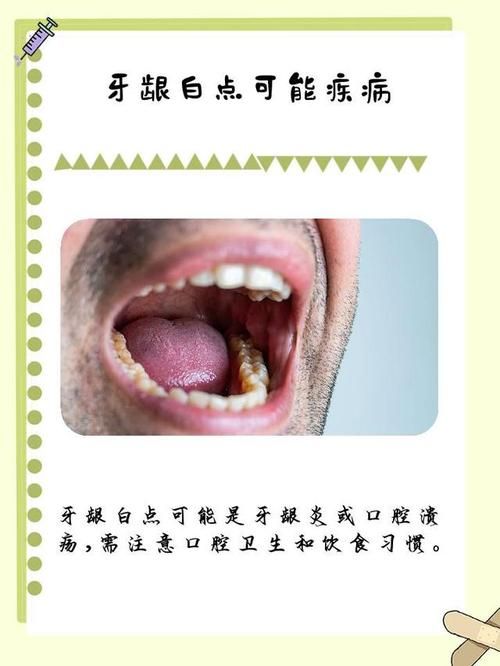 牙齿小白点是怎么回事？看完你就明白了！