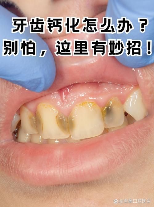 牙齿小白点是怎么回事？看完你就明白了！