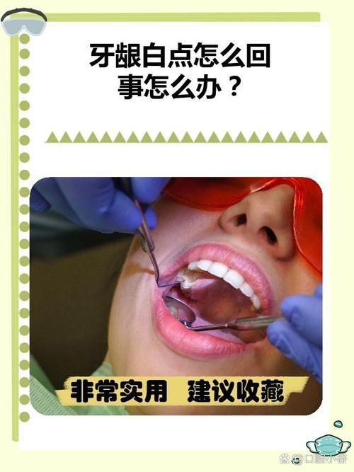 牙齿小白点是怎么回事？看完你就明白了！