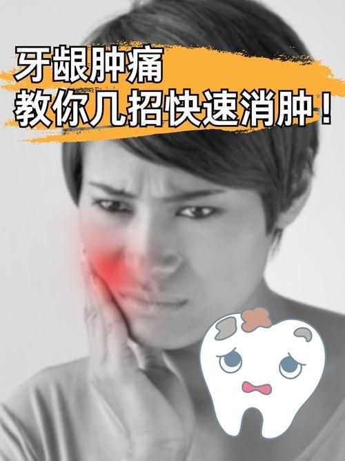 牙龈肿胀是什么病？看图识病，肉牙肿症状及处理方法！