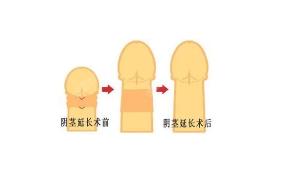 男性正常小弟状态特征及发育过程详解