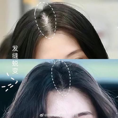美图秀秀修发际线技巧：告别尴尬发际线