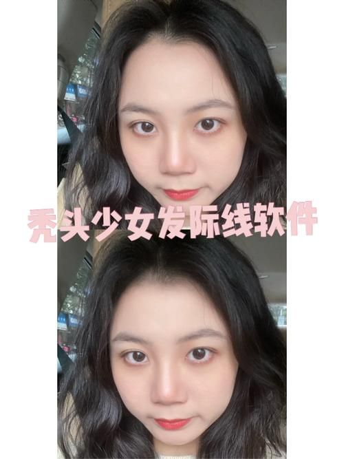 美图秀秀修发际线技巧：告别尴尬发际线
