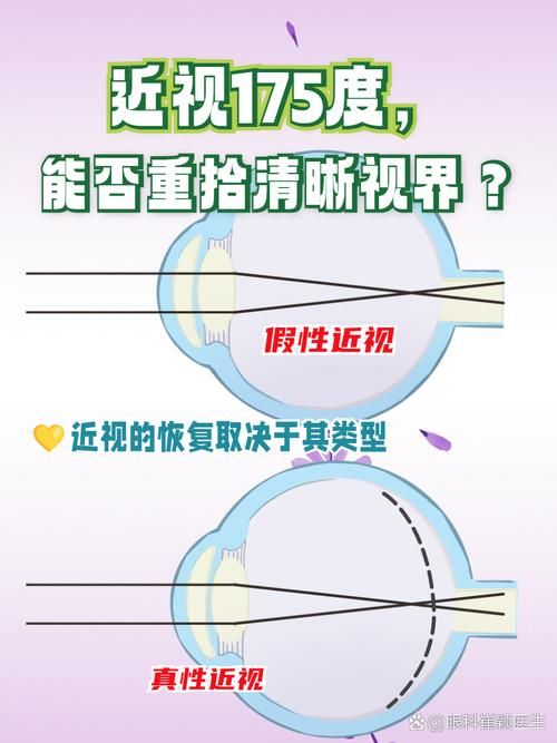 转动眼球真的可以治疗近视吗？过来人告诉你答案