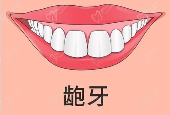 门牙的重要性：咬东西、保护口腔，甚至影响你的美貌！