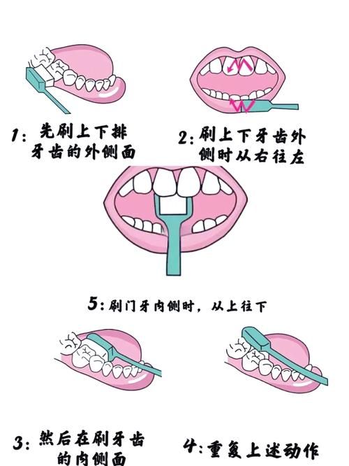 饭后多久刷牙最好？科学时间避免伤牙