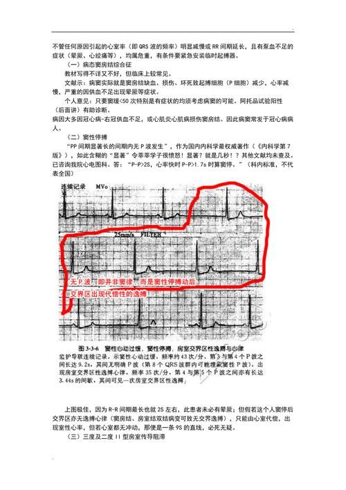 RiNaTest官网下载安装教程 手把手教你快速使用