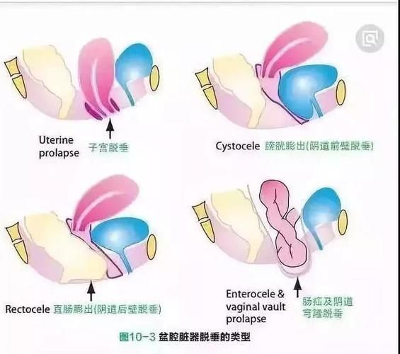 公共性生活汉化版最新改动这些内容别错过