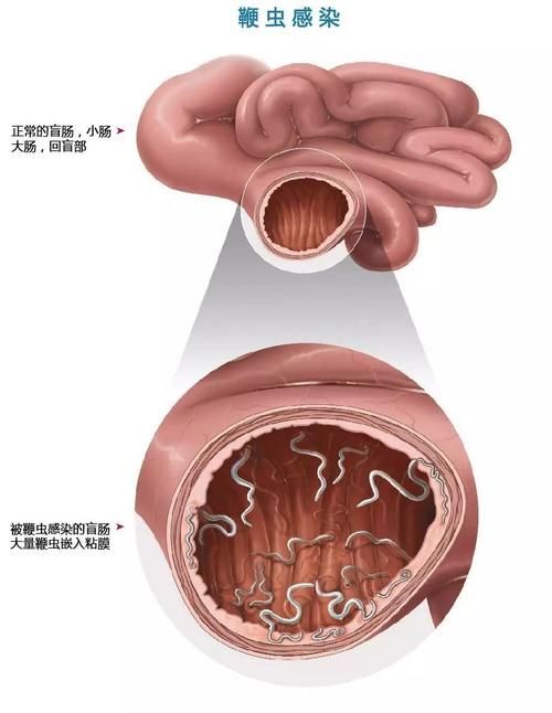 内部寄生虫在哪下载 快速获取资源教程与步骤