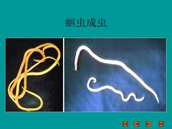 内部寄生虫在哪下载 快速获取资源教程与步骤