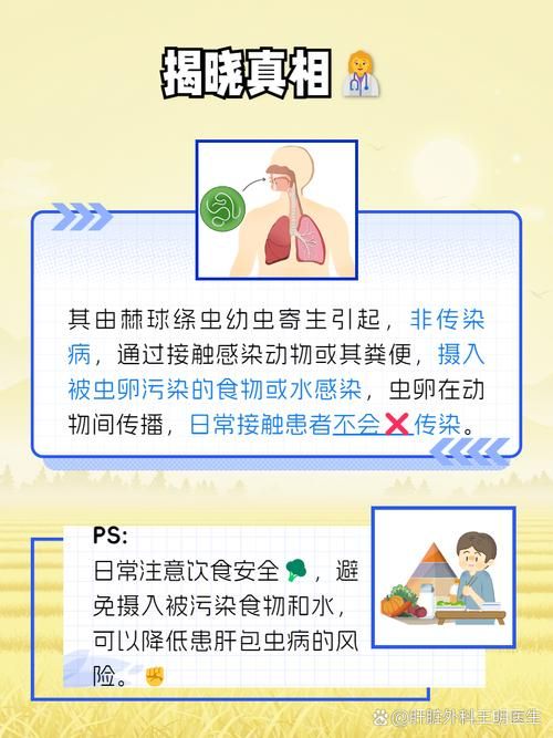 内部寄生虫官网问答 关于寄生虫的常见问题解答
