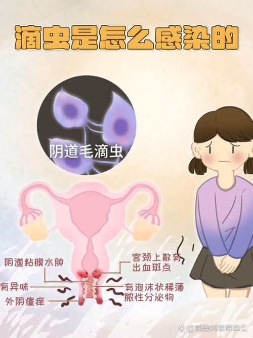 内部寄生虫官网问答 关于寄生虫的常见问题解答