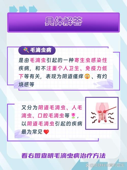 内部寄生虫最新版本常见问题解答与建议