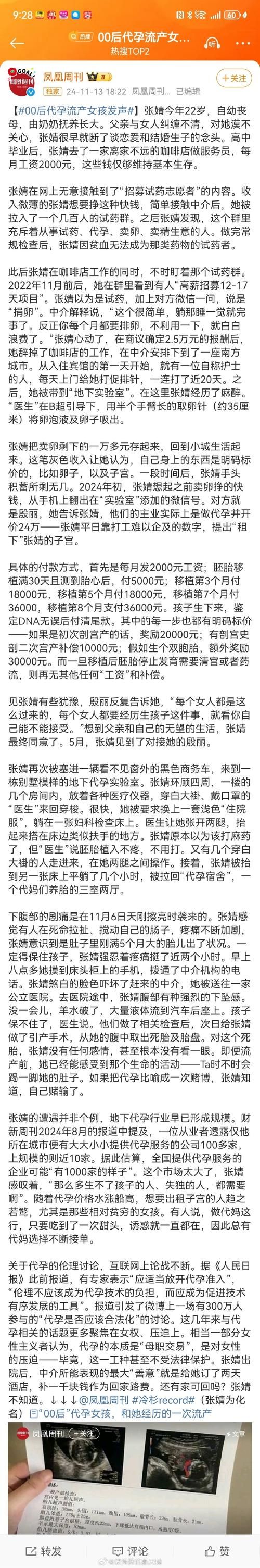 卵之少女在哪下载 最新资源获取方法分享