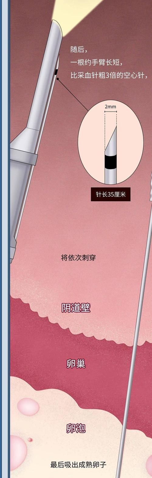 卵之少女安卓汉化版安装 解决中文版常见问题教程