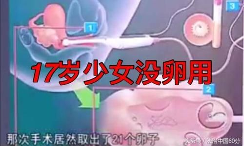 卵之少女游戏官网新手攻略 快速上手技巧分享