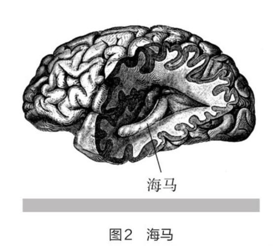 失忆症最新研究进展 专家解读记忆恢复新方法