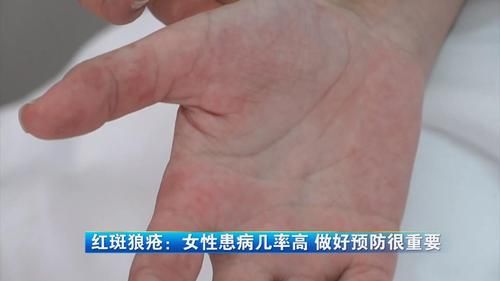女性瘾者最新症状表现 如何判断自己是否患病