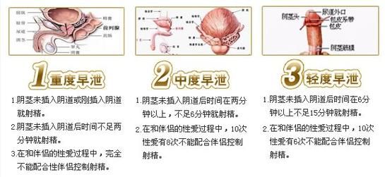 如何正确理解绝对禁止射精更新地址要求