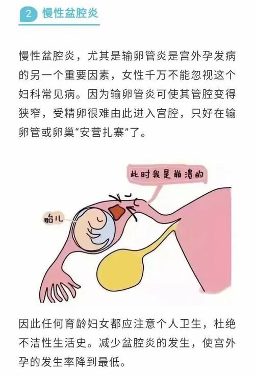妇科医生在哪下载 手机问诊软件免费获取指南