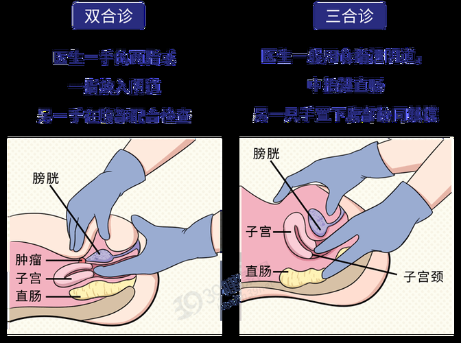 妇科医生汉化版最新更新内容详情 界面改进更易用